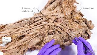 Brachial Plexus and Axillary Artery [upl. by Hanna]