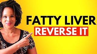 The Fastest Way To Reverse Fatty Liver  Results In Days [upl. by Tram566]