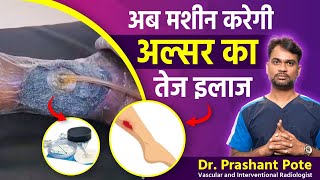 How VAC Dressing Treats Leg ulcer  Dr Prashant Pote [upl. by Yekram]