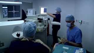 Laser Eye Surgery  Live  Optical Express [upl. by Nelram]