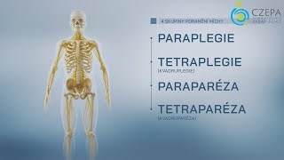 Consequences of Spinal Cord Injury A Comprehensive 3D Visualization [upl. by Ardiekal]