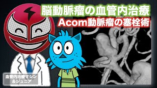 【脳動脈瘤の血管内治療】Acom動脈瘤のコイル塞栓術 [upl. by Poppy]