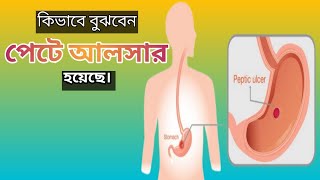 পেটে আলসার হয়েছে কিভাবে বুঝবেন  peptic ulcer  in bangla [upl. by Maclean323]