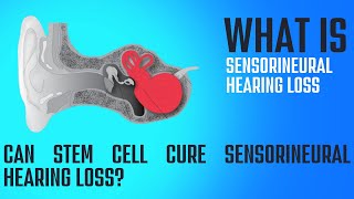 What is Sensorineural Hearing Loss How can it be treated [upl. by Eanad229]