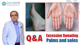 QnA with Dr Rohit Batra  Excessive Sweating Palms and soles  Hyperhidrosis Treatment  In Hindi [upl. by Caines414]