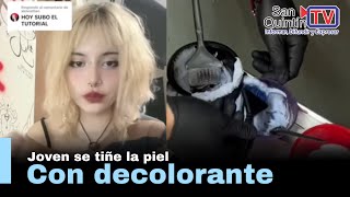 Mujer se aclara la piel con decolorante para cabello y lo comparte en redes [upl. by Marice111]