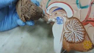 Anatomy Practical  DrHazem  Brain Stem amp Cerebellum amp HSection [upl. by Atnauqal503]