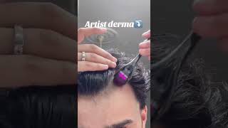 Derma Roller for Hair and Beard Growth dermaroller viralshorts howto newproducts fexicart [upl. by Avivah]