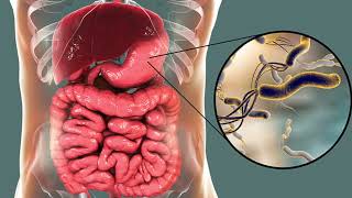 H PYLORI A BACTÉRIA CAUSADORA DE GASTRITE [upl. by Encratis]