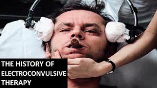 A Brief History of Electroconvulsive Therapy [upl. by Nanine]