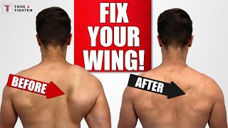 FIX Scapular Winging with Shoulder Blade Exercises [upl. by Ulick]