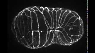 Epidermal morphogenesis of C elegans 線虫の表皮形態形成 [upl. by Kaela]