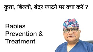 Rabies prevention and management after bite by Dog Cat amp Monkey Dog bite Vaccination Injection [upl. by Rysler]