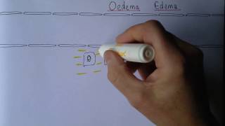 Edema exudates or transudates [upl. by Oleic]