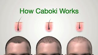 How Caboki Hair Building Fiber Works [upl. by Artaed924]