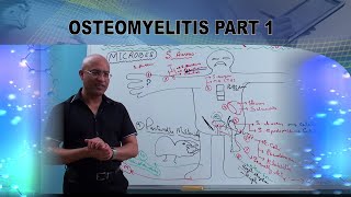 Osteomyelitis  Causes amp Symptoms  Bone Infection🩺 [upl. by Kassaraba]