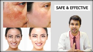 Safe Night Care Creams for SKIN WHITENING LIGHTENING amp PIGMENTATION  Brite 999 Cream [upl. by Eiduam]