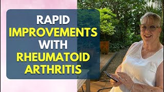 Rapid Improvements With Rheumatoid Arthritis [upl. by Aniale]