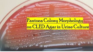 Characterizing Pantoea Colony Morphology on CLED Agar in Urine Culture [upl. by Mad]