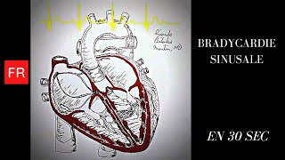 Arythmies Animation cardiaque et ECG  Bradycardie Sinusale Shorts [upl. by Nyladnor]