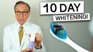 Hismile Purple Toothpaste for 10 Days  Dentist Review teethwhitening [upl. by Ayouqes673]