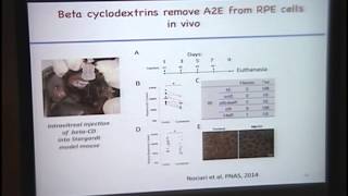 In Search for a Therapy for LipofuscinInduced Blinding Disease [upl. by Madonia620]