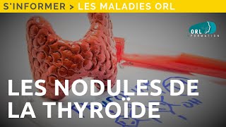 Information Patient  Les nodules de la thyroïde [upl. by Acireed69]