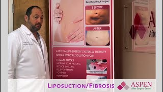 Liposuction Contour Irregularity  Stubborn Lipo Lumps and Bumps Treatment [upl. by Nannerb]