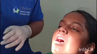 Pediatric dentistry A knowledge video of administration of local anesthesia in children [upl. by Einnal427]