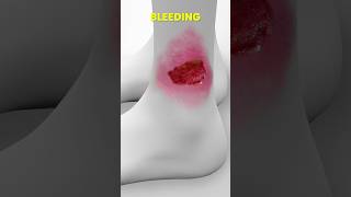 What Are Ulcers 🤔 How Ulcers Form 💊 drprashantpote shortsfeed2024 medicalshorts shorts [upl. by Gwenora]