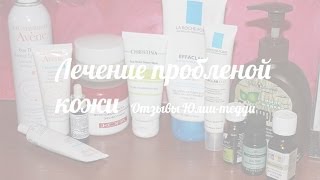 Лечение проблемной кожи Отзывы Юлии тедди [upl. by Leboff535]