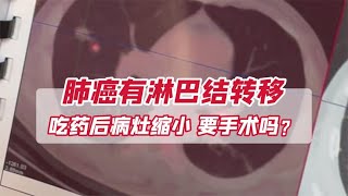 肺癌有淋巴结转移，吃药后肿瘤缩小！要不要做手术？ [upl. by Kinnon]