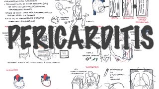 Pericarditis  Overview signs and symptoms pathophysiology diagnosis treatment [upl. by Ardnosal]