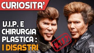 I DISASTRI Celebrità Prima e Dopo la Plastica Estrema [upl. by Orestes247]