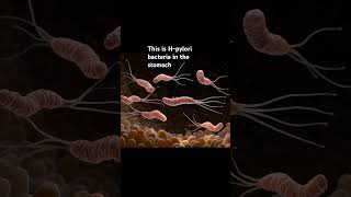 The H pylori bacteria that causes ulcers [upl. by Lael94]