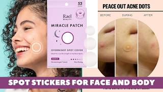 Top 5 Acne Pimple Patches for Covering Zits and Blemishes  Spot Stickers for Face and Skin [upl. by Angy]