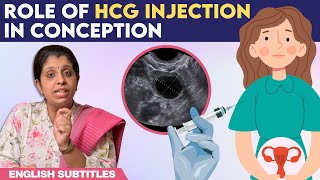 Role Of hCG Injection In Conception  hCG ஊசி செலுத்திய பிறகு கரு முட்டை எப்போது வெளிவரும் [upl. by Ciredec24]