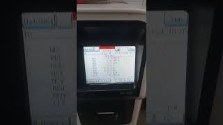 How To Print Your CBC Result in Sysmex Xp 100 sysmex hematologyanalyzer shorts [upl. by Miharbi566]