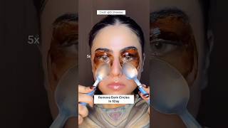 Remove Dark Circles Naturally At Home In 1DayUnderEye Dark Circles Remove Homeremedy dark shorts [upl. by Aronek]