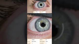 10 Rekomendasi Softlens Dengan Kadar Air Tinggi Terbaik ytshorts softlens softlensmurah ytviral [upl. by Hollenbeck470]