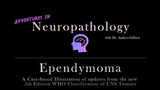 Ependymoma Update from the 5th Edition WHO Classification of CNS Tumors [upl. by Aihsoj]