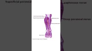 Common peroneal nerve lesion  features [upl. by Omocaig99]