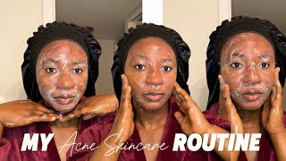 MY SIMPLE ACNEPRONE SKINCARE UPDATED MORNING ROUTINE [upl. by Kristi]