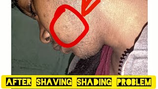 Minoxidil Beard transformationAfter shaving I faced bread shading problem☹️ [upl. by Aelber983]