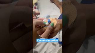 Cannula insertion of female patient nurses cannula doctor youtubeshorts shorts ytshorts neet [upl. by Wehner568]