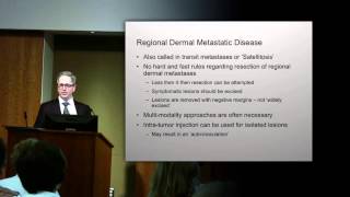 Treatment of Locally and Regionally Advanced Melanoma [upl. by Aiker207]