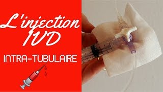 Injection IVD intra tubulaire [upl. by Eerazed]