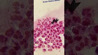 Gram Stain Smear  Neisseria gonorrhoeae  Microbiology science biology microbiology medical [upl. by Lashond184]