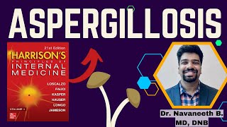 ASPERGILLOSIS  Pathogenesis  Clinical Features  Diagnosis  Treatment  Harrison [upl. by Demetra]