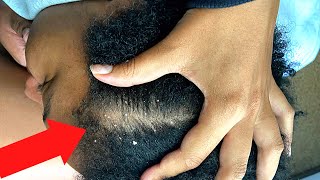 ASMR Scalp Scratching  Nit Picking Dandruff with Comb amp Massaging with Fingers to Help You Sleep [upl. by Junina315]